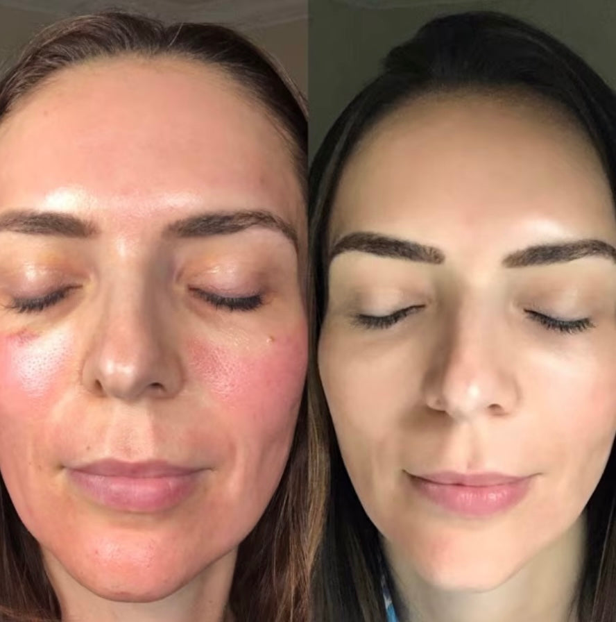 CO2 Lift Pro Carboxy Mask