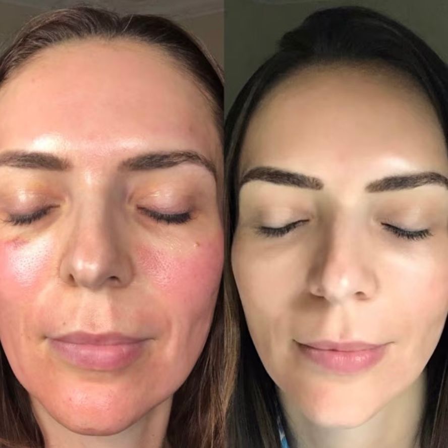 CO2 Lift Pro Carboxy Mask