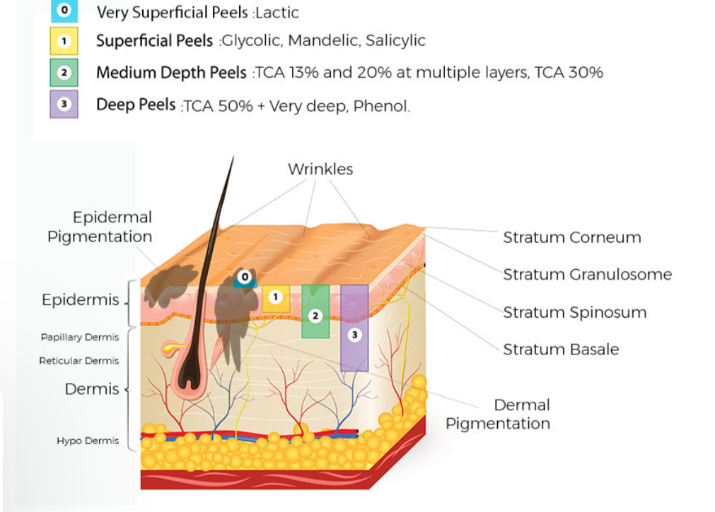 VI Peel Advanced Professional Treatment Chemical Peel
