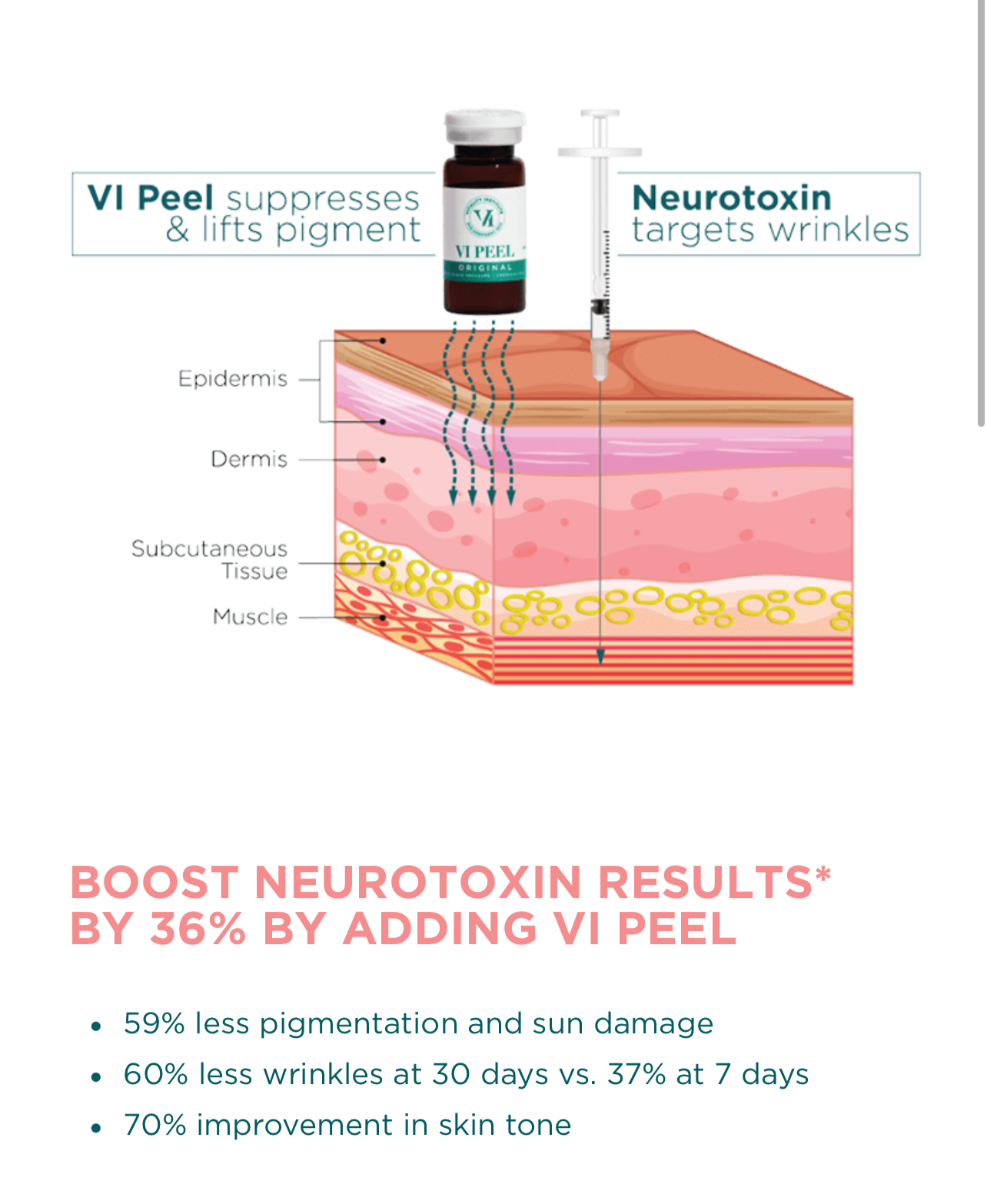 Vi peel precision plus chemical peel kit
