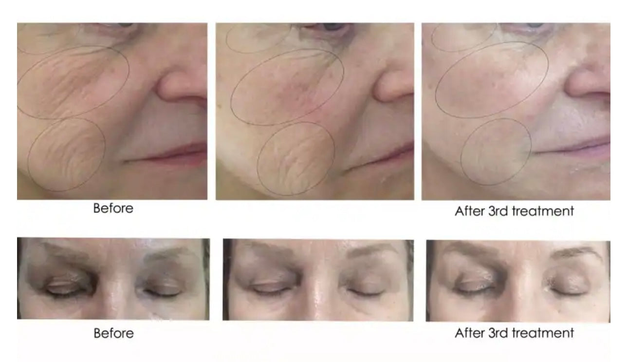 CO2 Lift Pro Carboxy Mask